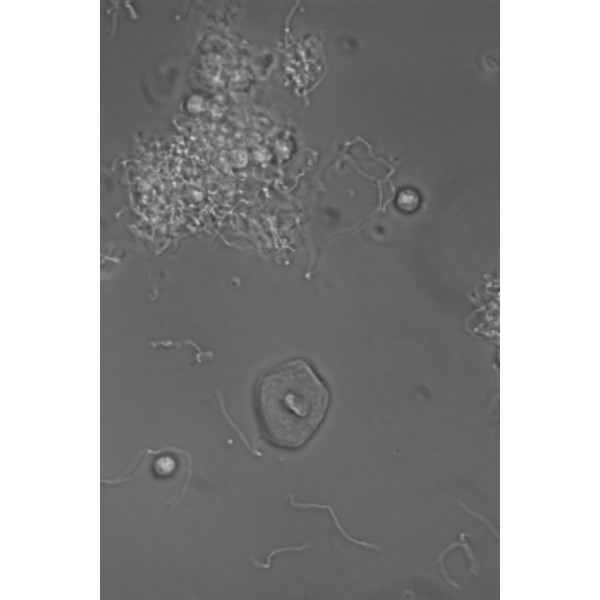 Hund Microscópio Medicus PH Plan, trino, 100x-1000x