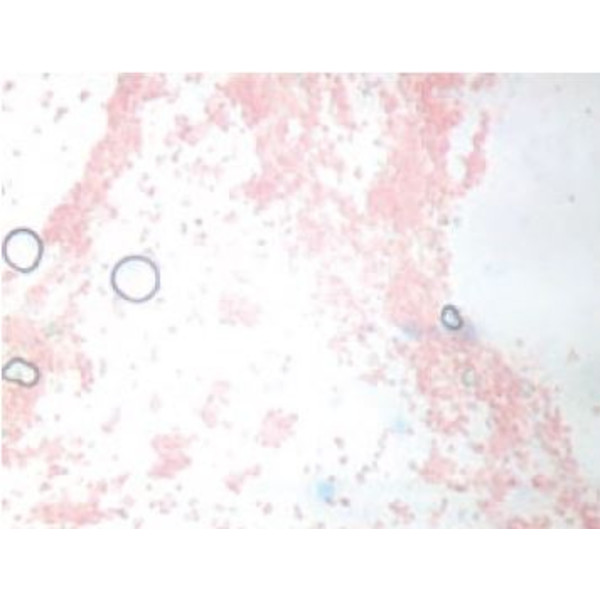 Novex Microscópio BTP 86.091-DFLED, Triocular