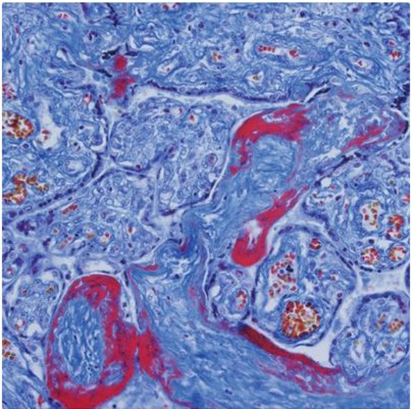 Evident Olympus Microscópio CX41 Pathology, ergo bino, hal,  40x,100x, 400x