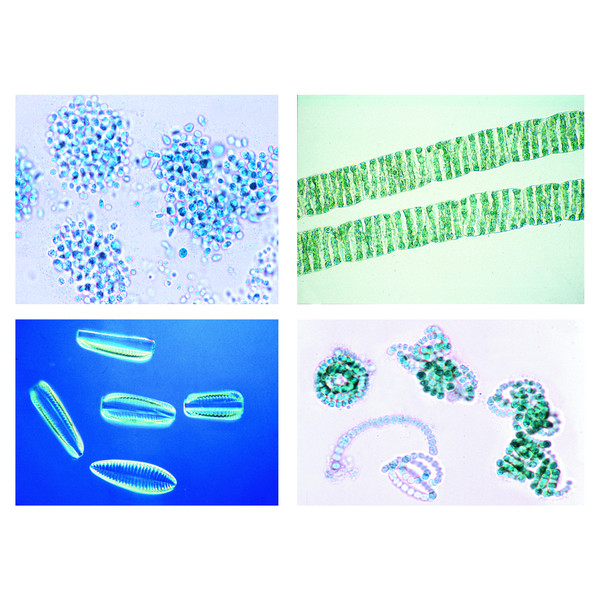 LIEDER Environment, II. Water Pollution. Problems and Results, 20 microscope slides