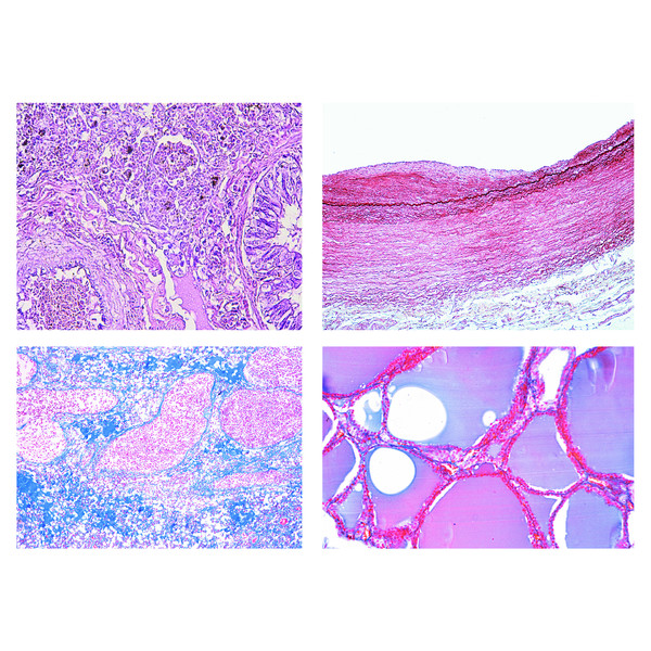 LIEDER Histologia patológica humana, pequena série (50 preparações)