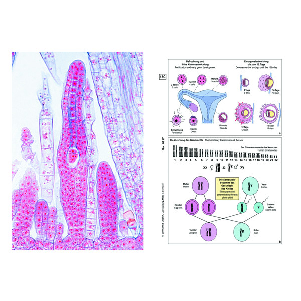 LIEDER Genetic slides, Supplementary Set of 12 slides, Student Set