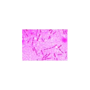 LIEDER Bacteria 25 Prep.