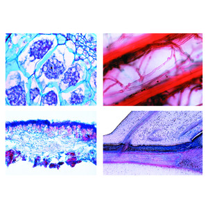 LIEDER Agriculture and Forestry, Part II. Bacteria and parasites of crops. Damage caused by environmental influences. 22  slides.