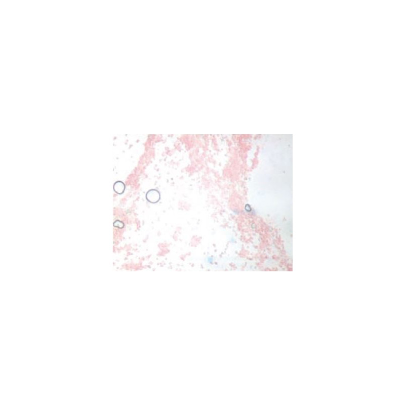 Novex Microscópio BTP 86.091-DFLED, Triocular