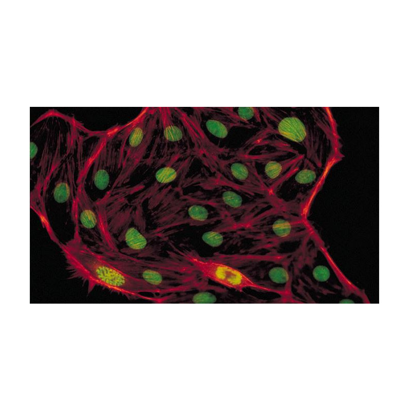 Evident Olympus Microscópio CX41 Fluorescência, trino, Hal, 40x,100x, 400x