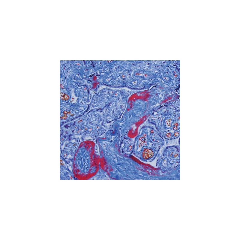 Evident Olympus Microscópio CX41 Patologia, trino, Hal, 40x,100x, 400x
