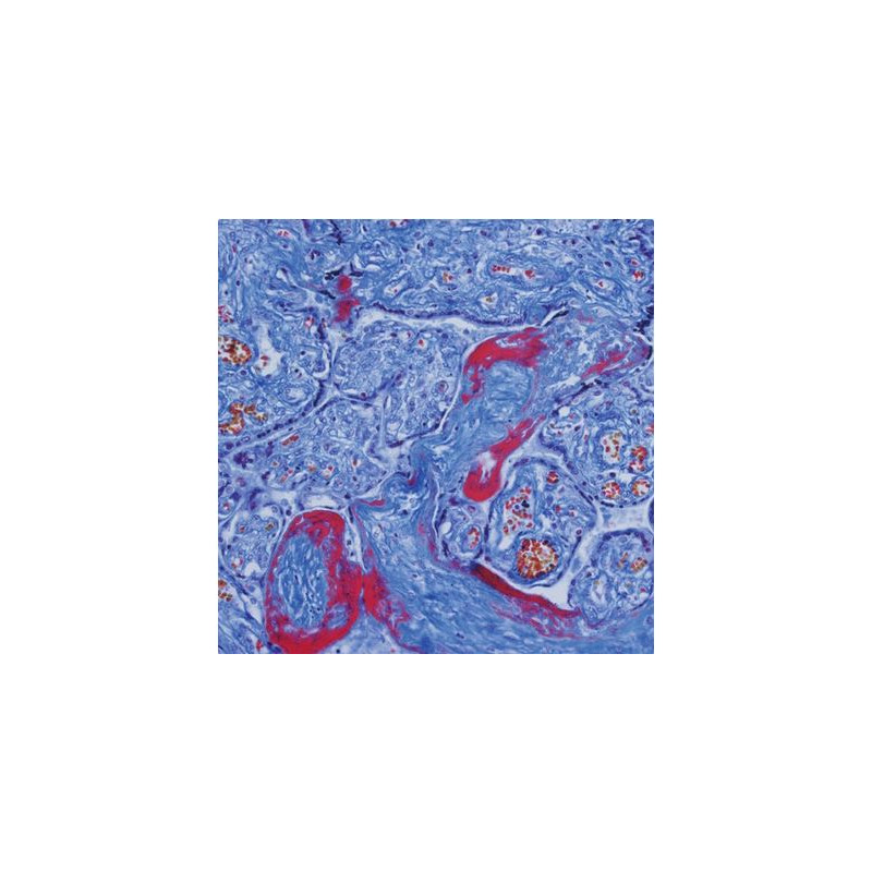 Evident Olympus Microscópio CX41 cytology, halogen, trino 40x,100x, 400x