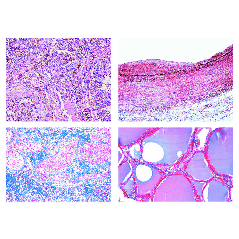 LIEDER Histologia patológica humana, pequena série (50 preparações)