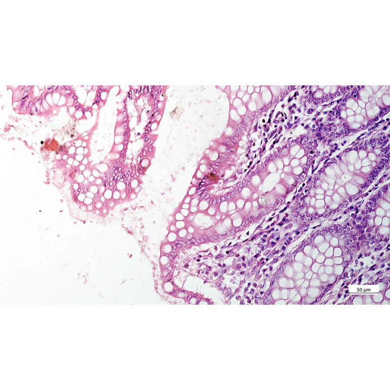 ZEISS Microscópio Axiovert 5 Digital, PH, FL, 50-400x, Ph1, 0,4 NA, LED, 5 MP, cor