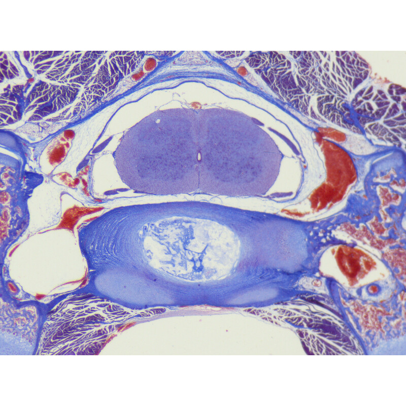 ZEISS Microscópio estéreo zoom Stemi 355, C Lab, trino, BF, DF, w.d. 110 mm, 10x/23, 5,5:1, 7,2x-40x, AL/DL, Spot C LED